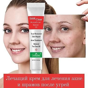 Крем для лица Quick Clear с масло чайного дерева. От акне, шрамов