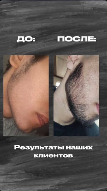 эко спрей от вшей как пользоваться: Сыворотка для роста волос и бороды RIJAL REAXIDIL 15% - Активный — 3