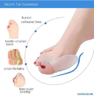 эспандер бабочка: Корректоры для большого пальца ноги от вальгусной деформации(косточки — 5