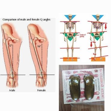 искры для обуви: Алтын батек кандайча иштейт? Гучженцзи ортопедиялык стелькилери — 3