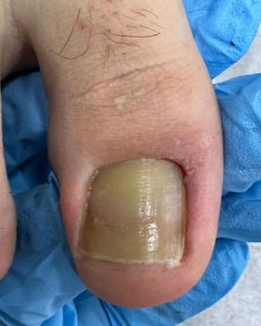 сколько стоит обучение на мастера маникюра: Выравнивание, Наращивание ногтей, Донаращивание ногтей, Маникюр, Педикюр, Услуги подолога, Консультация, Одноразовые расходные материалы — 7