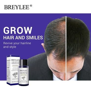 шампунь дисаар: Эфирное масло против выпадения волос на основе имбиря Можно добавить — 3