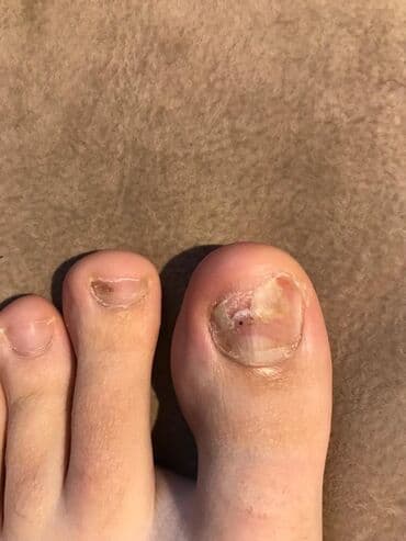 самый лучший эндокринолог рядом просп жибек жолу бишкек: Воосшие ногти, заболевания ногтей, стопы, бородавки, мозоли — 13