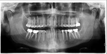 prm 20c: Gendex GP-300 Ортопантомограф (Оптг) Производство Финляндия Страна — 3