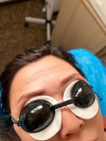 Лазерное удаление бровей.🌸 Перманентный макияж бровей 🌸 Лазер нового