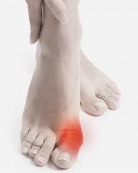 Корректоры для ношения с обувью Корректоры от косточки на ноге!