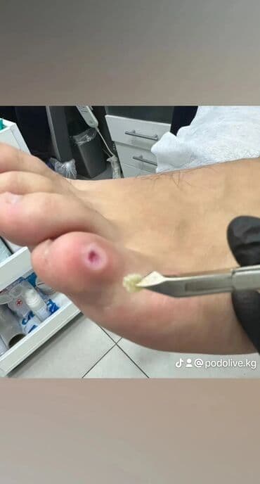 маникюр педикюр с выездом на дом: Коррекция вросших ногтей, Выравнивание, Услуги подолога, Маникюр, Педикюр, С выездом на дом, Консультация, Одноразовые расходные материалы — 2