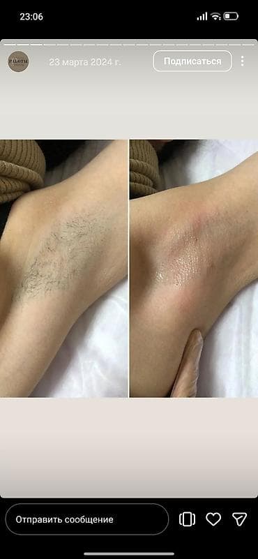 Кызматтар: Шугаринг, Мом менен эпиляция, Үйгө баруу кызматы менен — 4