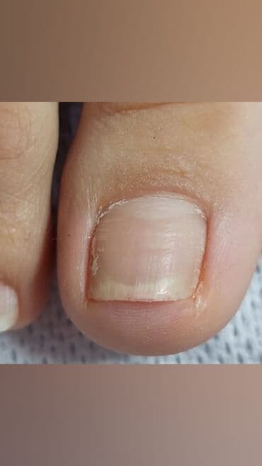 самый лучший эндокринолог рядом просп жибек жолу бишкек: Дизайн, Наращивание ногтей, Гель лак, шеллак, Маникюр, Педикюр, Услуги подолога, Консультация, Одноразовые расходные материалы — 4