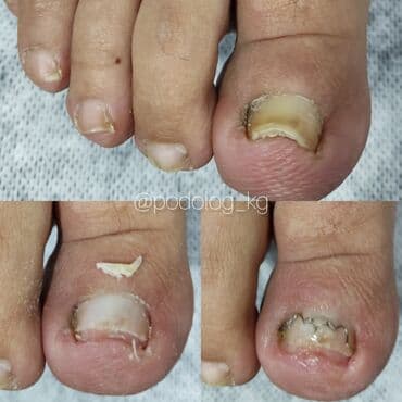 сколько стоит обучение на мастера маникюра: Коррекция вросших ногтей, Маникюр, Педикюр, Услуги подолога, Консультация — 8