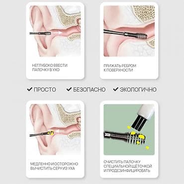 Медтовары: Многоразовый металлический набор инструментов для чистки ушей, ушной — 5