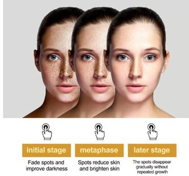 личный кабинет эрсаг кыргызстан: США Крем интенсивный отбеливающий антивозрастной Данный крем — 3