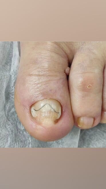 сколько стоит обучение на мастера маникюра: Коррекция вросших ногтей, Маникюр, Педикюр, Услуги подолога, Консультация, Одноразовые расходные материалы — 9