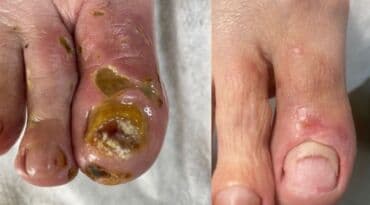 арендовать дом: Выравнивание, Услуги подолога, С выездом на дом, Консультация, Одноразовые расходные материалы — 15