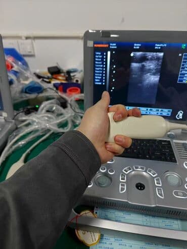 Срочно продаю Новый Портативный УЗИ аппарат 3D аппарат SUNBRIGHT с — 4