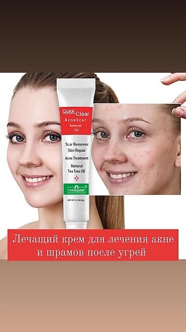 Лечащий крем против акне и шрамов после угрей на основе чайного дерева