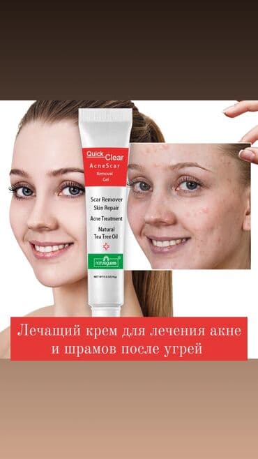 крем день и ночь китайский отзывы: Лечащий крем против акне и шрамов после угрей на основе чайного дерева — 1