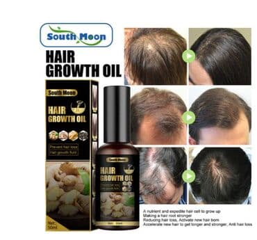 шампунь дисаар: ❄️ США От выпадения волос от облысения от алоп еции для густоты волос — 5