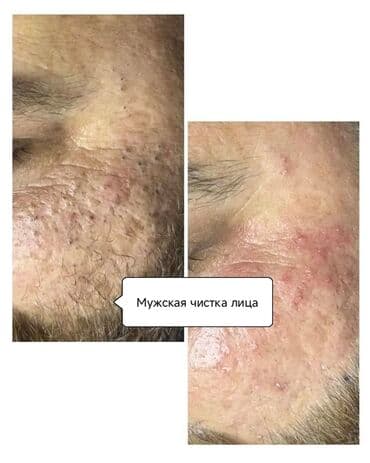 частный роддом бишкек цены: Косметология, Пилинг, Ботулинотерапия, Плазмолифтинг, Консультация, Требуются модели, Сертифицированный косметолог — 7