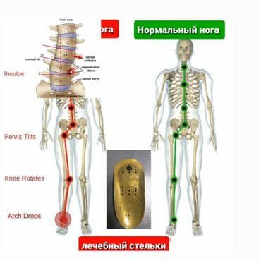 искры для обуви: Алтын батек кандайча иштейт? Гучженцзи ортопедиялык стелькилери — 6