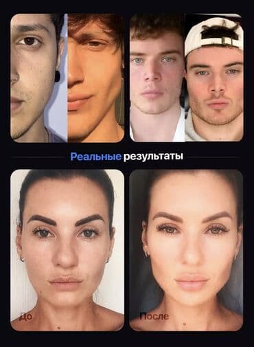 аппарат от храпа: 🔥 ЭСПАНДЕР ДЛЯ СКУЛ — НАГРУЗКА 40 КГ 🔥 Хочешь чёткие, выраженные — 7