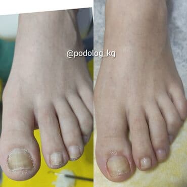 сколько стоит обучение на мастера маникюра: Коррекция вросших ногтей, Маникюр, Педикюр, Услуги подолога, Консультация — 14