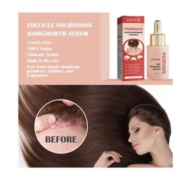 Киреге берилүүчү кийимдер: ❄️ США псориаз головы средство с валмарта питательная эссенция для — 4