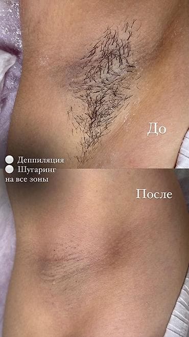 мойка салон красоты: Депиляция и бьюти-услуги - Шугаринг/депиляция для всех зон — 2