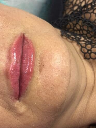 самый лучший эндокринолог рядом просп жибек жолу бишкек: Косметология, Маски, Мезотерапия, Удаление носогубных складок, Гипоаллергенные материалы, Консультация, Сертифицированный косметолог — 8