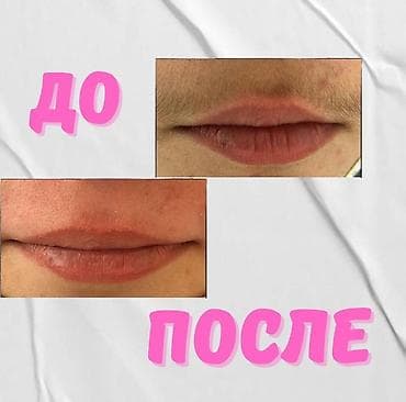 Шугаринг на дому Опыт работы более 4лет Умею работать с горячим