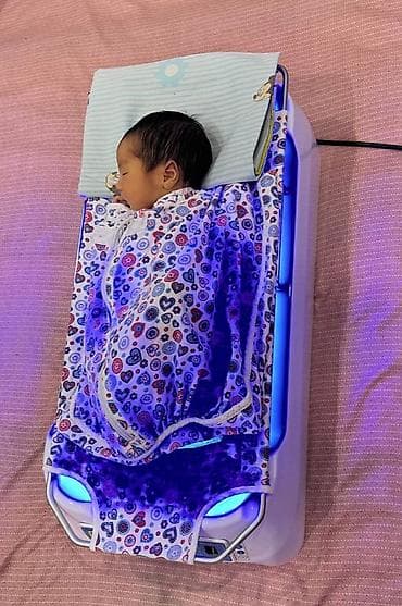 Медициналык жабдуулар: Фотолампа от желтушки в аренду. Сверхъяркая светодиодная медицинская — 7