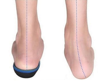 белорусская обувь для проблемных ног: Стельки ортопедические(специализированные) от плоскостопия! Для — 24