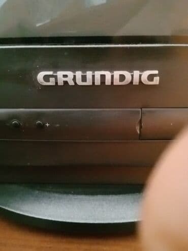 компьютерная томография: В отл . состоянии — 4