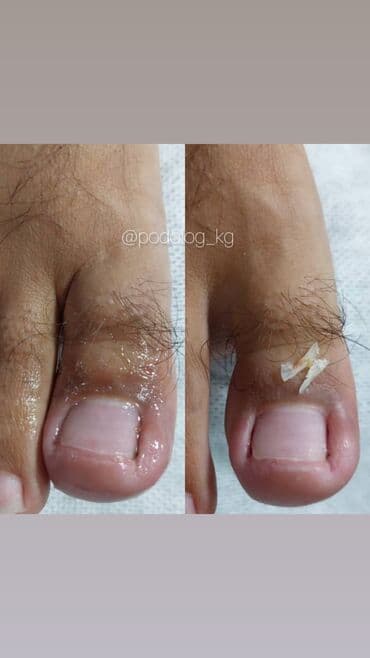 самый лучший эндокринолог рядом просп жибек жолу бишкек: Дизайн, Наращивание ногтей, Гель лак, шеллак, Маникюр, Педикюр, Услуги подолога, Консультация, Одноразовые расходные материалы — 5