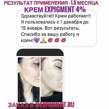 Крем Expigment напрямую с Турции. В составе гидрохинон. доставка по