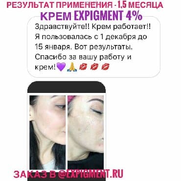 крем для отбеливания кожи и устранения пигментных пятен: Крем Expigment напрямую с Турции. В составе гидрохинон. доставка по — 1