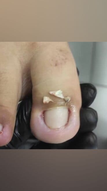 маникюр педикюр с выездом на дом: Коррекция вросших ногтей, Выравнивание, Услуги подолога, Маникюр, Педикюр, С выездом на дом, Консультация, Одноразовые расходные материалы — 11