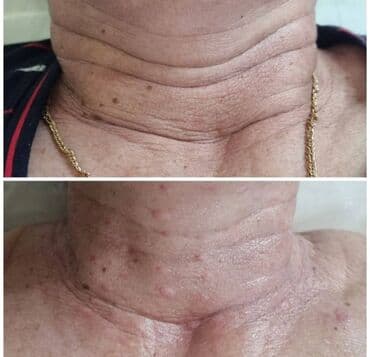 самый лучший эндокринолог рядом просп жибек жолу бишкек: Косметология, Ботокс, Биоревитализация, Ботулинотерапия, Консультация, Гипоаллергенные материалы, Сертифицированный косметолог — 4