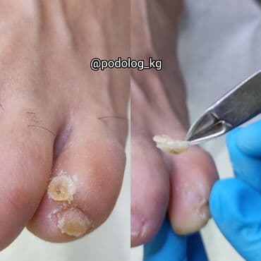 сколько стоит обучение на мастера маникюра: Коррекция вросших ногтей, Маникюр, Педикюр, Услуги подолога, Консультация — 15