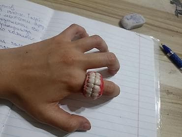 накладные зубы: Кольцо, Унисекс, Без вставки — 1