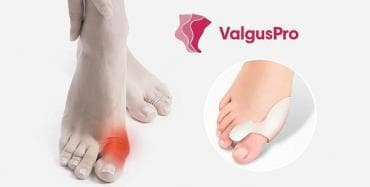 эспандер бабочка: Корректоры для большого пальца ноги от вальгусной деформации(косточки — 4