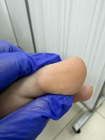 обувь медицинская: Услуги подолога, Консультация — 2