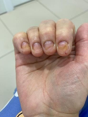обучение маникюр бишкек: Подолог Бишкек Подолог, Бишкек, вросший ноготь, трещины на пятках — 1