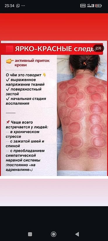 Массаж: Массаж | Сутулость, нарушение осанки — 4