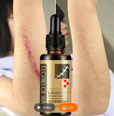 растяжки: Восстанавливающая эссенция LAVENDER . Масло для удаления растяжек и — 4