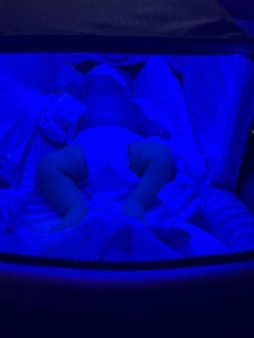 Медицинские лампы: Фотолампа для лечения желтушки у новорождённых MAINENG - — 8