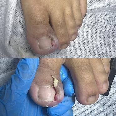 сапоги керза: Маникюр • Педикюр • Подология Профессиональный уход за руками и — 2