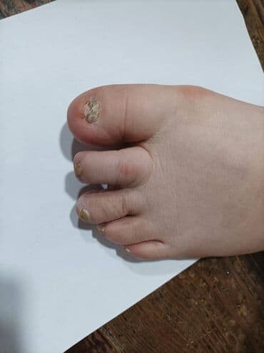 самый лучший эндокринолог рядом просп жибек жолу бишкек: Воосшие ногти, заболевания ногтей, стопы, бородавки, мозоли — 7