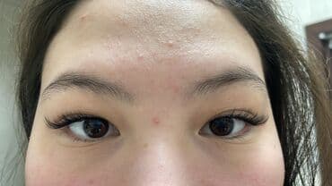 сколько стоит поставить брекеты на зубы в бишкеке: Наращивание ресниц - Классическое и объемное наращивание с — 3