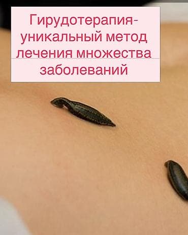 Массаж | Лечебный массаж | Остеохондроз, Протрузия, Защемление седалищного нерва | С выездом на дом, Консультация